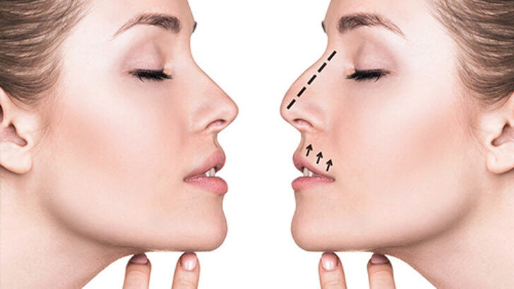 Hazır Estetik Doktoru Web Sitesi